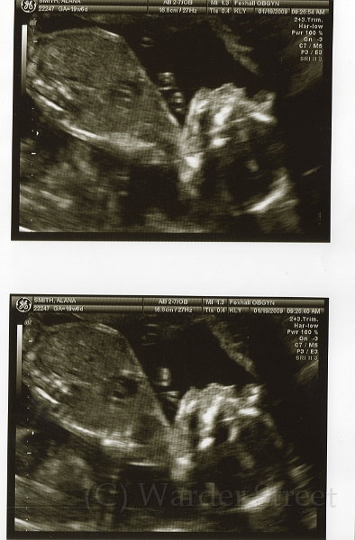 3rd Ultrasound 02.jpg